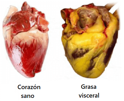 grasa_visceral.png